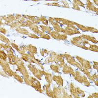 Immunohistochemistry of paraffin-embedded Rat brain using TRAP1 Polyclonal Antibody at dilution of 1:100 (40x lens) .