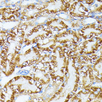 Immunohistochemistry of paraffin-embedded Mouse kidney using TRAP1 Polyclonal Antibody at dilution of 1:100 (40x lens) .