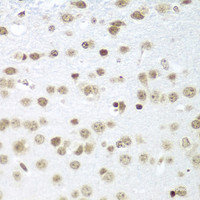 Immunohistochemistry of paraffin-embedded Mouse brain using SAP18 Polyclonal Antibody at dilution of 1:100 (40x lens) .