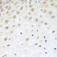 Immunohistochemistry of paraffin-embedded Human esophagus using BCAS2 Polyclonal Antibody at dilution of 1:100 (40x lens) .