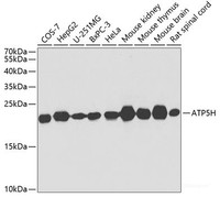 Western blot analysis of extracts of various cell lines using ATP5H Polyclonal Antibody at dilution of 1:1000.