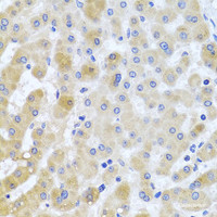 Immunohistochemistry of paraffin-embedded Human liver damage using EIF3M Polyclonal Antibody at dilution of 1:100 (40x lens) .