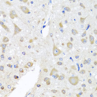 Immunohistochemistry of paraffin-embedded Rat brain using EIF3M Polyclonal Antibody at dilution of 1:100 (40x lens) .