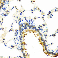 Immunohistochemistry of paraffin-embedded Rat lung using CRTAP Polyclonal Antibody at dilution of 1:100 (40x lens) .