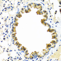 Immunohistochemistry of paraffin-embedded Mouse lung using CRTAP Polyclonal Antibody at dilution of 1:100 (40x lens) .