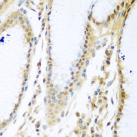 Immunohistochemistry of paraffin-embedded Human stomach using MYBBP1A Polyclonal Antibody at dilution of 1:100 (40x lens) .