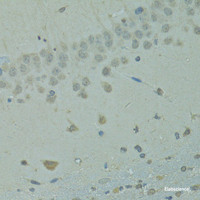 Immunohistochemistry of paraffin-embedded Rat brain using IVNS1ABP Polyclonal Antibody at dilution of 1:100 (40x lens) .