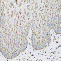 Immunohistochemistry of paraffin-embedded Human esophagus using IGF2BP3 Polyclonal Antibody at dilution of 1:200 (40x lens) .