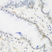 Immunohistochemistry of paraffin-embedded Human stomach using IGF2BP3 Polyclonal Antibody at dilution of 1:200 (40x lens) .