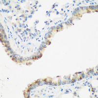 Immunohistochemistry of paraffin-embedded Mouse lung using IGF2BP3 Polyclonal Antibody at dilution of 1:200 (40x lens) .