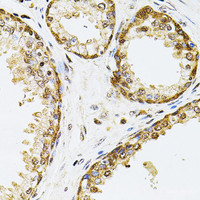 Immunohistochemistry of paraffin-embedded Human prostate using POP4 Polyclonal Antibody at dilution of 1:100 (40x lens) .