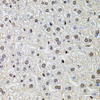 Immunohistochemistry of paraffin-embedded Mouse liver using POP4 Polyclonal Antibody at dilution of 1:100 (40x lens) .