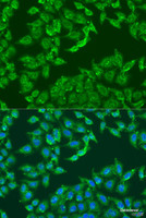 Immunofluorescence analysis of U2OS cells using ADAP1 Polyclonal Antibody at dilution of 1:100. Blue: DAPI for nuclear staining.