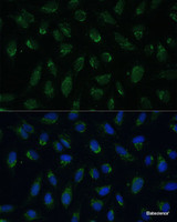 Immunofluorescence analysis of U-2 OS cells using PHB2 Polyclonal Antibody at dilution of 1:100 (40x lens) . Blue: DAPI for nuclear staining.