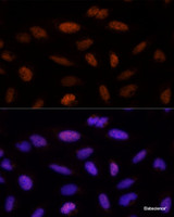 Immunofluorescence analysis of U-2 OS cells using ADNP Polyclonal Antibody at dilution of 1:100 (40x lens) . Blue: DAPI for nuclear staining.