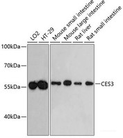 Western blot analysis of extracts of various cell lines using CES3 Polyclonal Antibody at dilution of 1:3000.