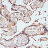 Immunohistochemistry of paraffin-embedded Human placenta using MYCBP Polyclonal Antibody at dilution of 1:100 (40x lens) .
