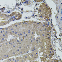 Immunohistochemistry of paraffin-embedded Human stomach using UBE2S Polyclonal Antibody at dilution of 1:100 (40x lens) .