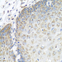 Immunohistochemistry of paraffin-embedded Human esophagus using TMOD3 Polyclonal Antibody at dilution of 1:100 (40x lens) .