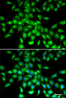 Immunofluorescence analysis of A549 cells using SERPINA10 Polyclonal Antibody