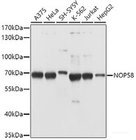 Western blot analysis of extracts of various cell lines using NOP58 Polyclonal Antibody at dilution of 1:1000.