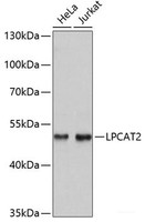 Western blot analysis of extracts of various cell lines using LPCAT2 Polyclonal Antibody at dilution of 1:3000.