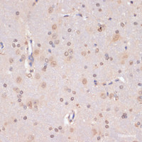 Immunohistochemistry of paraffin-embedded Rat brain using PIDD Polyclonal Antibody at dilution of 1:100 (40x lens) .