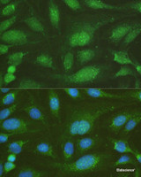 Immunofluorescence analysis of U-2OS cells using NHEJ1 Polyclonal Antibody at dilution of 1:100. Blue: DAPI for nuclear staining.