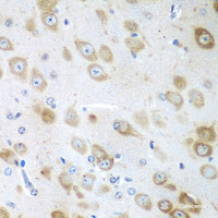 Immunohistochemistry of paraffin-embedded Mouse brain using GFM1 Polyclonal Antibody at dilution of 1:100 (40x lens) .