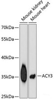 Western blot analysis of extracts of various cell lines using ACY3 Polyclonal Antibody at dilution of 1:3000.