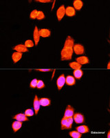 Immunofluorescence analysis of Hela cells using DNAJC19 Polyclonal Antibody at dilution of 1:100 (40x lens) . Blue: DAPI for nuclear staining.