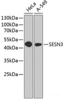 Western blot analysis of extracts of various cell lines using SESN3 Polyclonal Antibody at dilution of 1:1000.