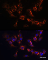 Immunofluorescence analysis of C6 cells using ARL13B Polyclonal Antibody at dilution of 1:100. Blue: DAPI for nuclear staining.