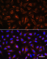 Immunofluorescence analysis of U-2 OS cells using ARL13B Polyclonal Antibody at dilution of 1:100. Blue: DAPI for nuclear staining.