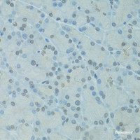 Immunohistochemistry of paraffin-embedded Rat pancreas using GTF2H2C Polyclonal Antibody at dilution of 1:100 (40x lens) .