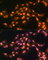 Immunofluorescence analysis of C6 cells using Snail Polyclonal Antibody at dilution of 1:100. Blue: DAPI for nuclear staining.