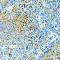 Immunohistochemistry of paraffin-embedded Mouse spleen using TLR4 Polyclonal Antibody at dilution of 1:100 (40x lens) .