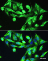 Immunofluorescence analysis of U2OS cells using CXCR5 Polyclonal Antibody at dilution of 1:100. Blue: DAPI for nuclear staining.