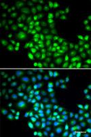 Immunofluorescence analysis of U2OS cells using FOXP1 Polyclonal Antibody