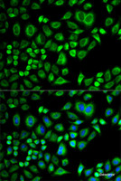 Immunofluorescence analysis of A549 cells using APOD Polyclonal Antibody