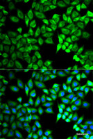 Immunofluorescence analysis of A549 cells using C10orf2 Polyclonal Antibody