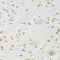 Immunohistochemistry of paraffin-embedded Mouse brain using CBFB Polyclonal Antibody at dilution of 1:200 (40x lens) .