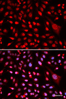Immunofluorescence analysis of U2OS cells using CBFB Polyclonal Antibody