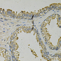 Immunohistochemistry of paraffin-embedded Human prostate using FABP1 Polyclonal Antibody at dilution of 1:100 (40x lens) .