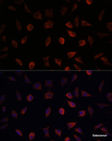 Immunofluorescence analysis of L929 cells using FABP1 Polyclonal Antibody at dilution of 1:100. Blue: DAPI for nuclear staining.