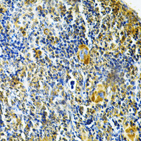 Immunohistochemistry of paraffin-embedded Mouse spleen using GLRX Polyclonal Antibody at dilution of 1:200 (40x lens) .