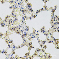 Immunohistochemistry of paraffin-embedded Rat lung using GTF2H2 Polyclonal Antibody at dilution of 1:100 (40x lens) .