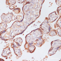 Immunohistochemistry of paraffin-embedded Human placenta using KLKB1 Polyclonal Antibody at dilution of 1:100 (40x lens) .