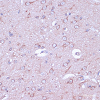 Immunohistochemistry of paraffin-embedded Rat brain using PRKACB Polyclonal Antibody at dilution of 1:100 (40x lens) .