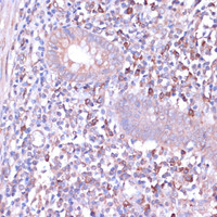 Immunohistochemistry of paraffin-embedded Human appendix using PRKACB Polyclonal Antibody at dilution of 1:100 (40x lens) .